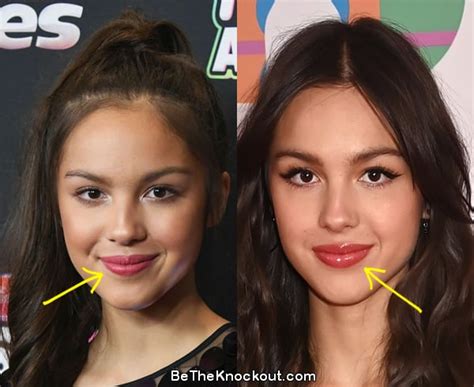 does olivia rodrigo have implants|Olivia Rodrigo Plastic Surgery Comparison Photos